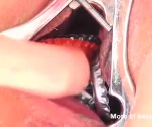 Kroondoppen in haar kut